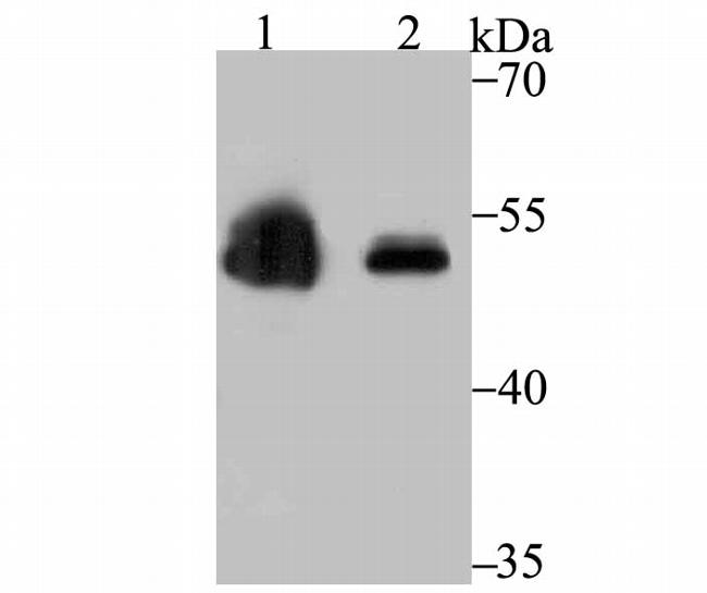 ZSCAN4 Antibody in Western Blot (WB)