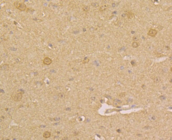 PGP9.5 Antibody in Immunohistochemistry (Paraffin) (IHC (P))