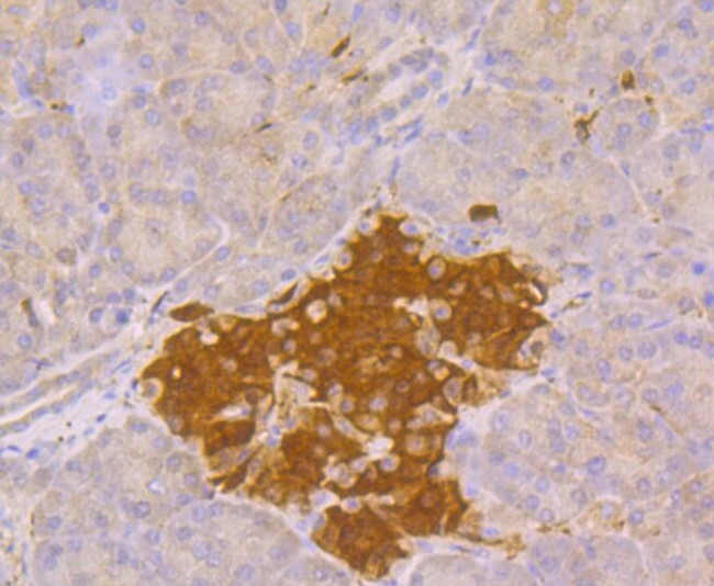 PGP9.5 Antibody in Immunohistochemistry (Paraffin) (IHC (P))