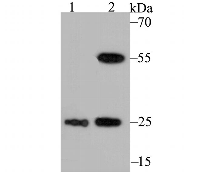 PGP9.5 Antibody in Western Blot (WB)