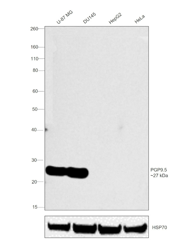 PGP9.5 Antibody in Western Blot (WB)