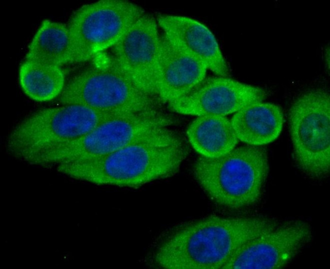 ASS1 Antibody in Immunocytochemistry (ICC/IF)