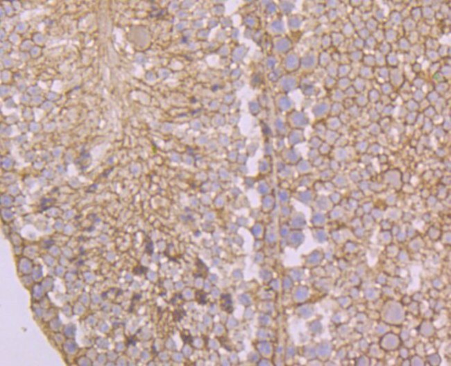 ASS1 Antibody in Immunohistochemistry (Paraffin) (IHC (P))