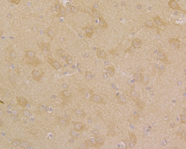 ATF6 Antibody in Immunohistochemistry (Paraffin) (IHC (P))