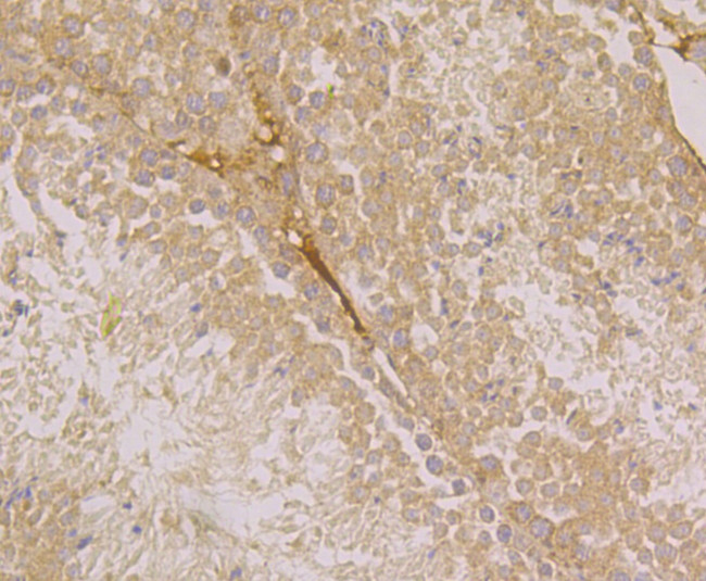 ATF6 Antibody in Immunohistochemistry (Paraffin) (IHC (P))