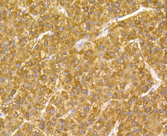 GPX1 Antibody in Immunohistochemistry (Paraffin) (IHC (P))