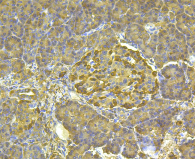 ALDH1A1 Antibody in Immunohistochemistry (Paraffin) (IHC (P))