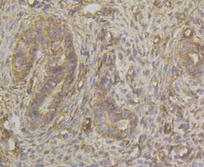 HLA-ABC Antibody in Immunohistochemistry (Paraffin) (IHC (P))