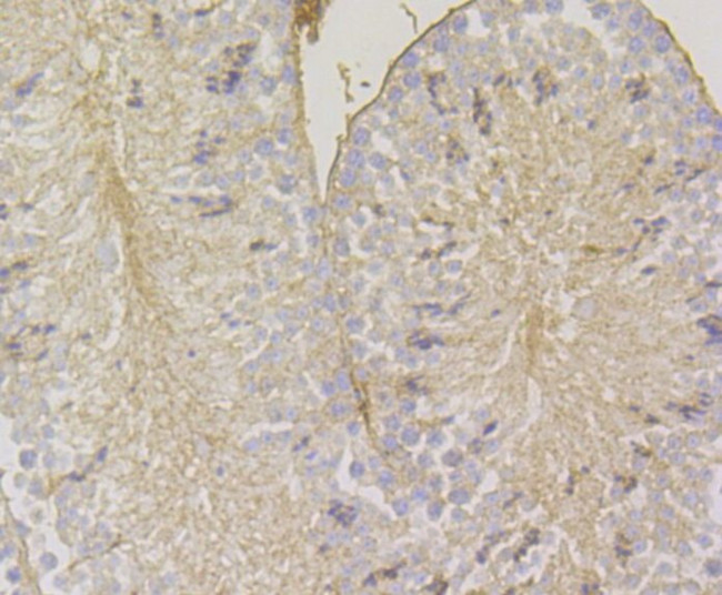 HLA-ABC Antibody in Immunohistochemistry (Paraffin) (IHC (P))