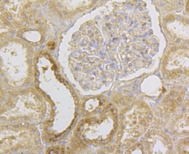 HLA-ABC Antibody in Immunohistochemistry (Paraffin) (IHC (P))