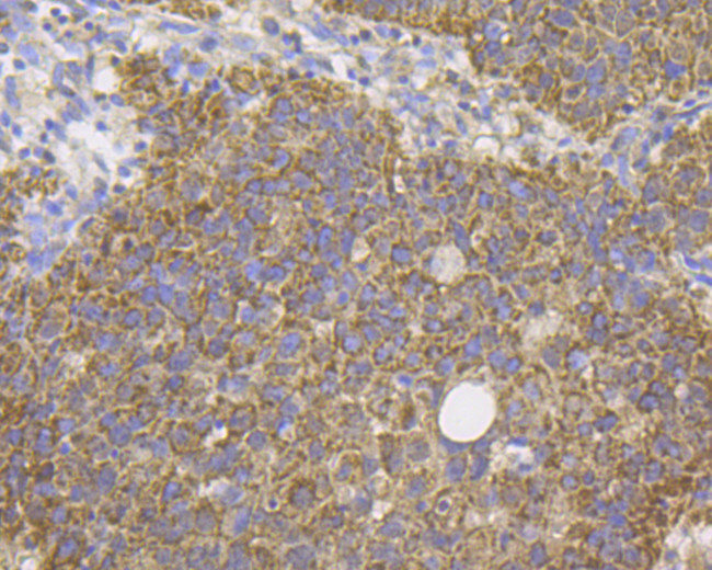 DAPK1 Antibody in Immunohistochemistry (Paraffin) (IHC (P))