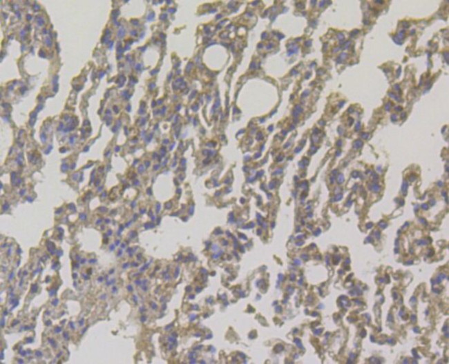 DAPK1 Antibody in Immunohistochemistry (Paraffin) (IHC (P))