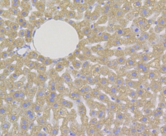 DAPK1 Antibody in Immunohistochemistry (Paraffin) (IHC (P))