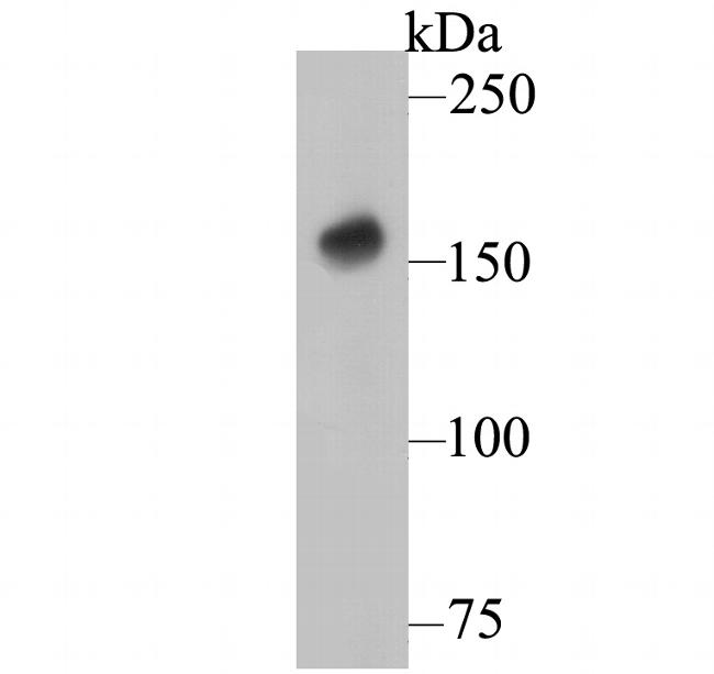 DAPK1 Antibody in Western Blot (WB)