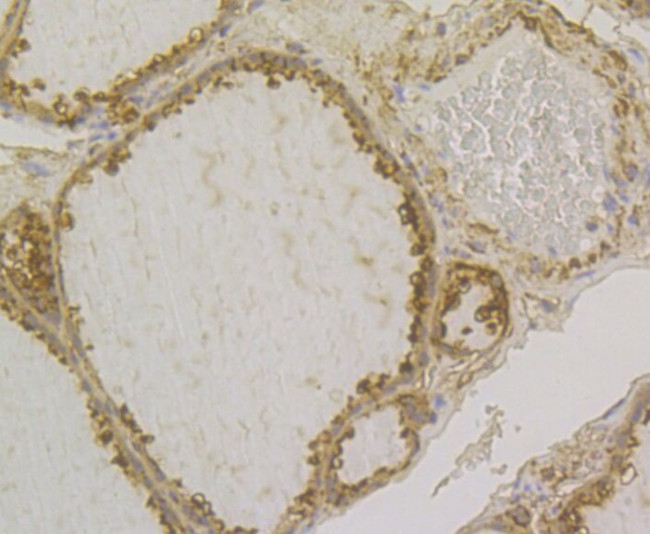 GSTP1 Antibody in Immunohistochemistry (Paraffin) (IHC (P))