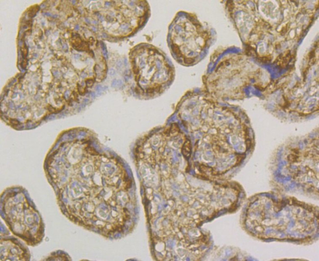 GSTP1 Antibody in Immunohistochemistry (Paraffin) (IHC (P))