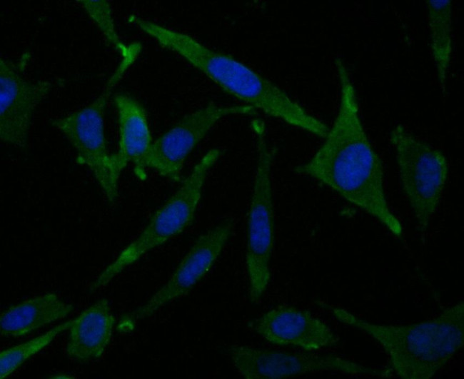 HIP1 Antibody in Immunocytochemistry (ICC/IF)