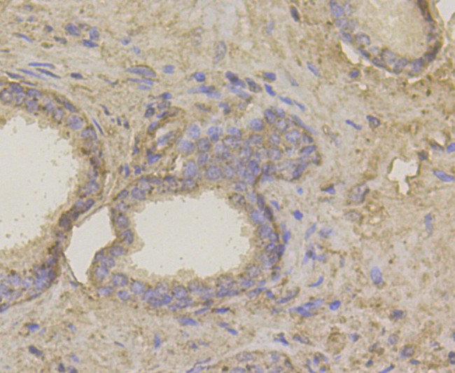 HIP1 Antibody in Immunohistochemistry (Paraffin) (IHC (P))