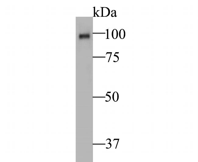 Auxin response factor Antibody in Western Blot (WB)