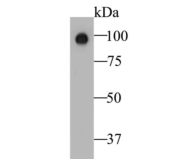 Auxin response factor Antibody in Western Blot (WB)