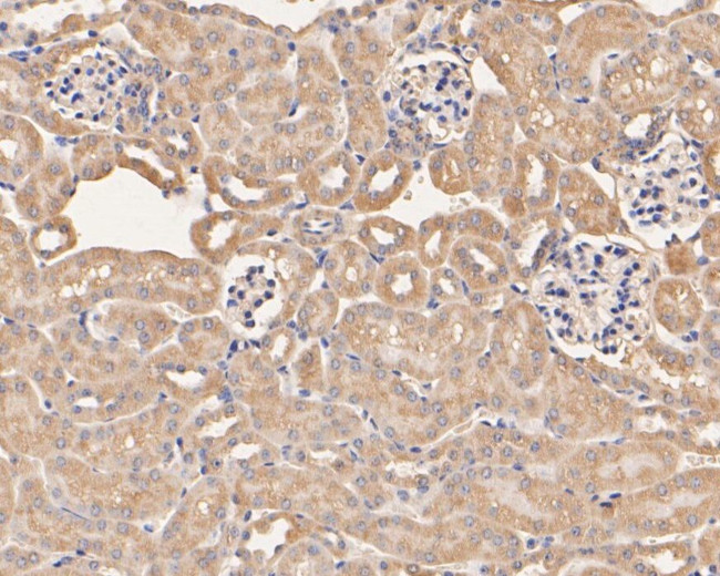 SERPINC1 Antibody in Immunohistochemistry (Paraffin) (IHC (P))