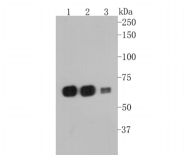 SERPINC1 Antibody in Western Blot (WB)