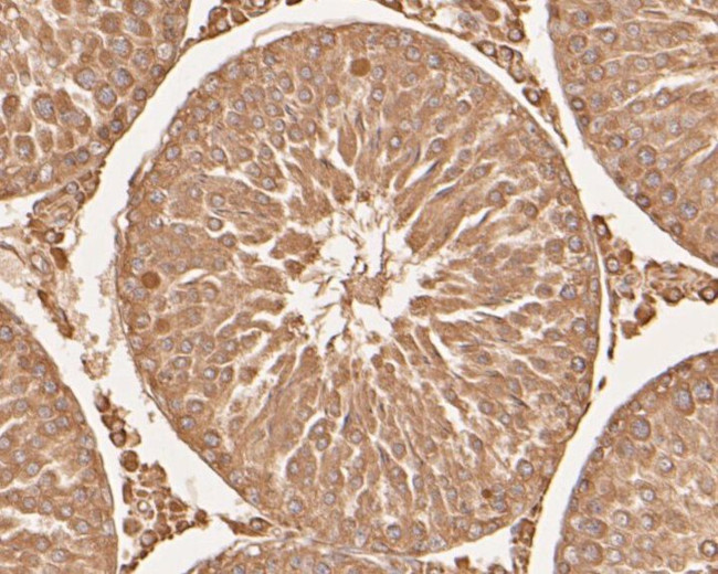 SERPINC1 Antibody in Immunohistochemistry (Paraffin) (IHC (P))