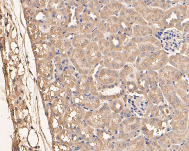 SERPINC1 Antibody in Immunohistochemistry (Paraffin) (IHC (P))