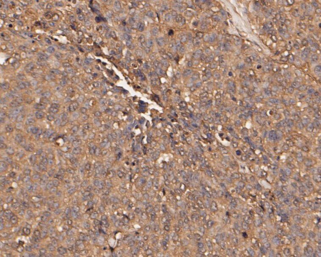 SERPINC1 Antibody in Immunohistochemistry (Paraffin) (IHC (P))