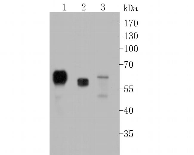 SERPINC1 Antibody in Western Blot (WB)