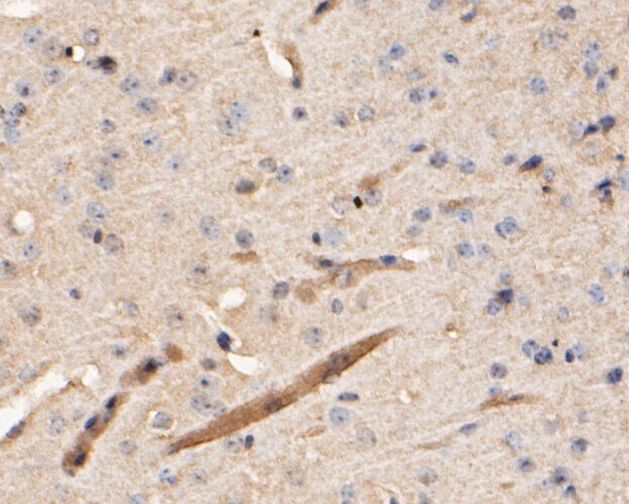 Cathepsin D Antibody in Immunohistochemistry (Paraffin) (IHC (P))