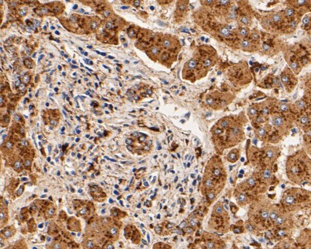 Cathepsin D Antibody in Immunohistochemistry (Paraffin) (IHC (P))