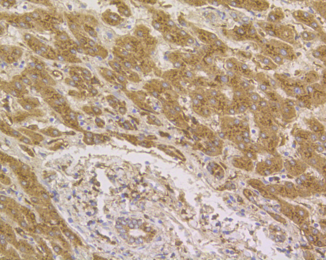 Cathepsin D Antibody in Immunohistochemistry (Paraffin) (IHC (P))