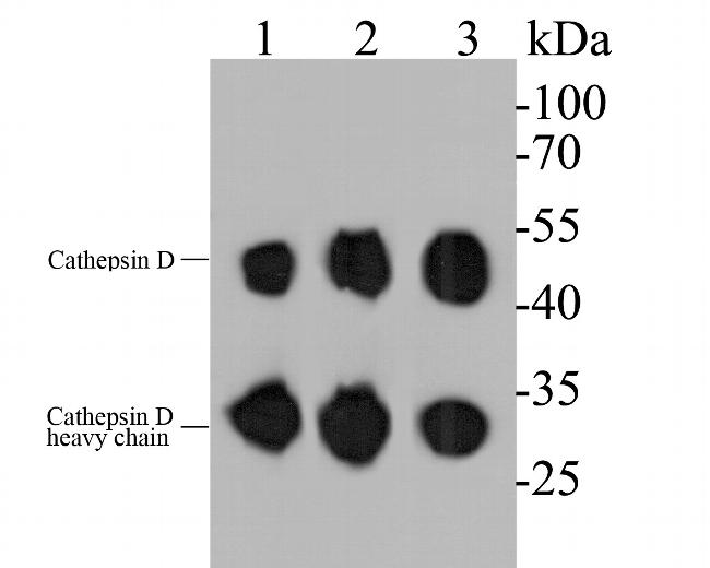 Cathepsin D Antibody in Western Blot (WB)