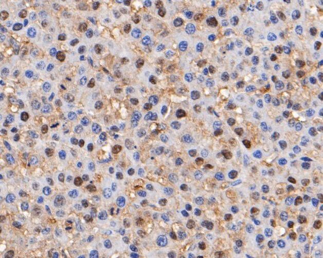 Thymidine Phosphorylase Antibody in Immunohistochemistry (Paraffin) (IHC (P))