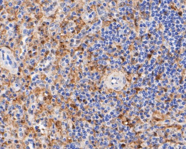 Thymidine Phosphorylase Antibody in Immunohistochemistry (Paraffin) (IHC (P))