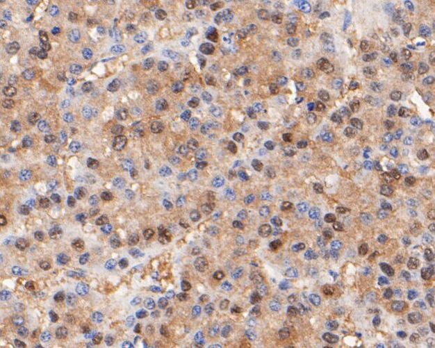 Thymidine Phosphorylase Antibody in Immunohistochemistry (Paraffin) (IHC (P))