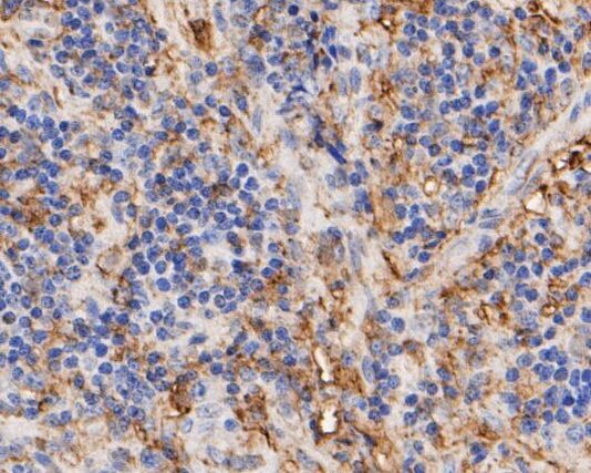 Thymidine Phosphorylase Antibody in Immunohistochemistry (Paraffin) (IHC (P))