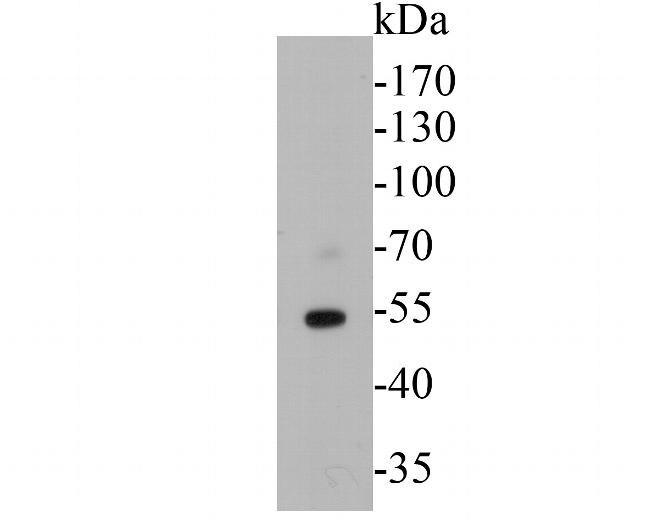 Thymidine Phosphorylase Antibody in Western Blot (WB)