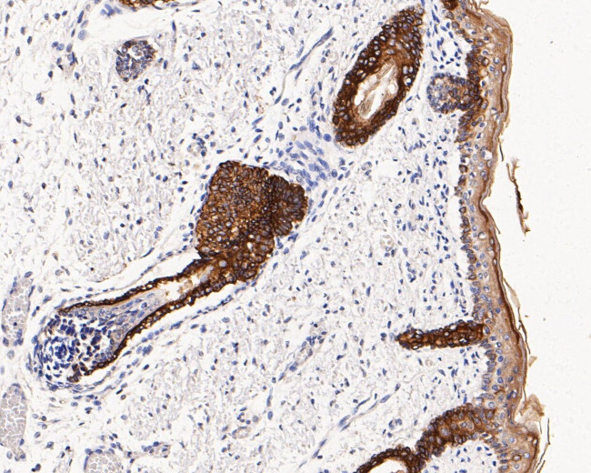 Cytokeratin 17 Antibody in Immunohistochemistry (Paraffin) (IHC (P))