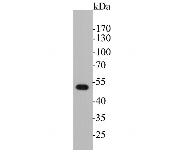 Cytokeratin 17 Antibody in Western Blot (WB)