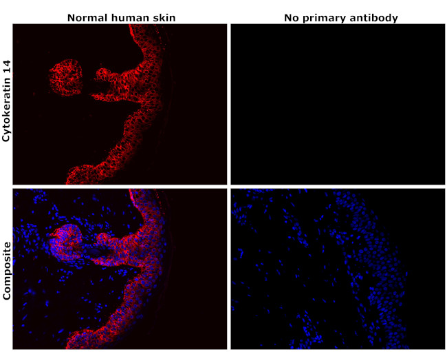 Cytokeratin 14 Antibody in Immunohistochemistry (Paraffin) (IHC (P))