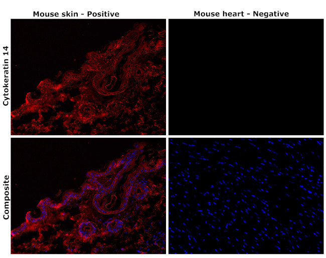 Cytokeratin 14 Antibody in Immunohistochemistry (Paraffin) (IHC (P))