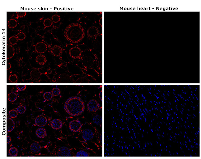 Cytokeratin 14 Antibody in Immunohistochemistry (Paraffin) (IHC (P))