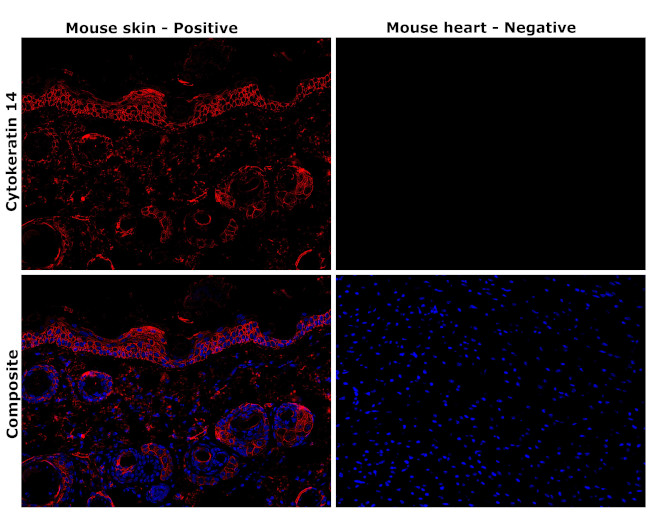 Cytokeratin 14 Antibody in Immunohistochemistry (Paraffin) (IHC (P))