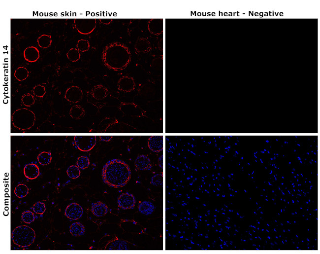 Cytokeratin 14 Antibody in Immunohistochemistry (Paraffin) (IHC (P))