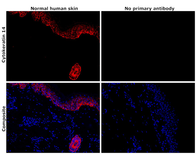 Cytokeratin 14 Antibody in Immunohistochemistry (Paraffin) (IHC (P))