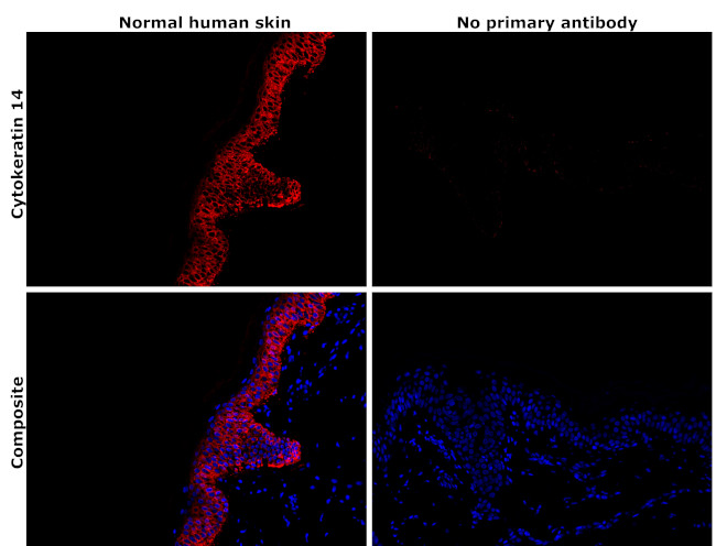 Cytokeratin 14 Antibody in Immunohistochemistry (Paraffin) (IHC (P))