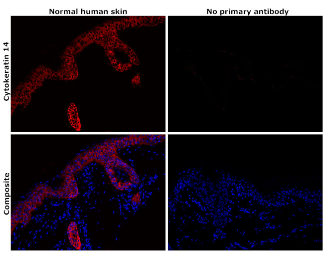 Cytokeratin 14 Antibody in Immunohistochemistry (Paraffin) (IHC (P))