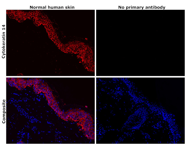 Cytokeratin 14 Antibody in Immunohistochemistry (Paraffin) (IHC (P))